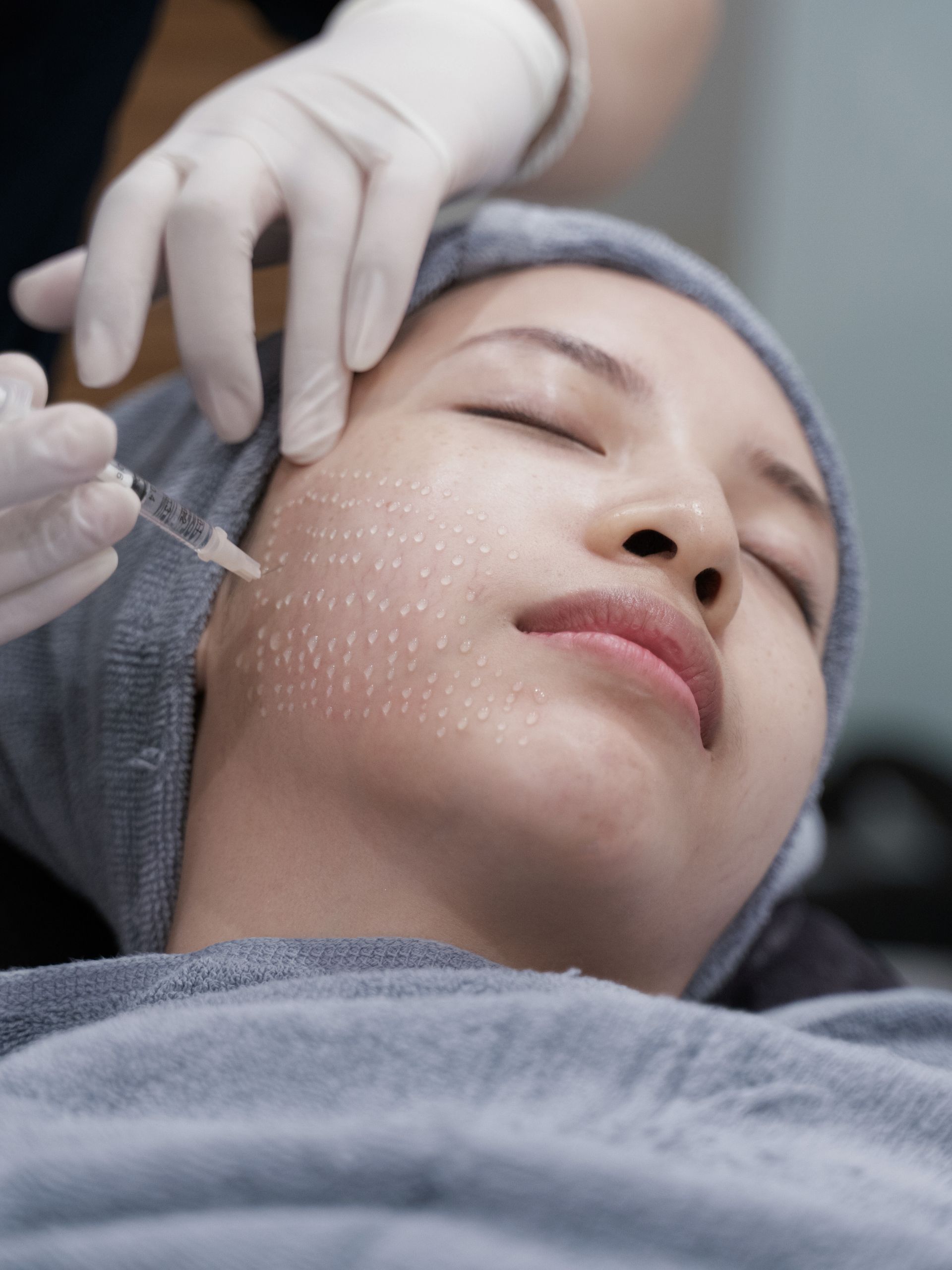 Mesotherapie Hamburg